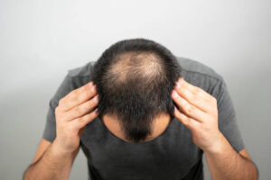 Hempley Hair Loss Lotion skroutz, amazon - Ελλάδα